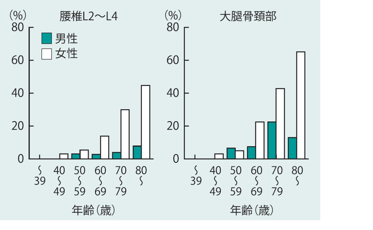 骨粗しょう症の年代別有病率